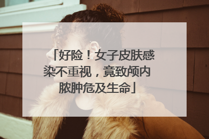 好险！女子皮肤感染不重视，竟致颅内脓肿危及生命